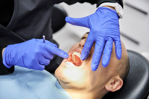 Best Knocked-Out Tooth (Avulsed Tooth) Treatment in Suisun City, CA